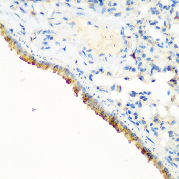 c-CBL Antibody - Immunohistochemistry of paraffin-embedded mouse lung using CBL antibody at dilution of 1:200 (40x lens).