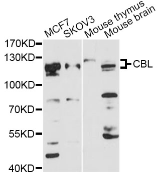 c-CBL Antibody - Western blot analysis of extracts of various cell lines, using CBL antibody at 1:3000 dilution. The secondary antibody used was an HRP Goat Anti-Rabbit IgG (H+L) at 1:10000 dilution. Lysates were loaded 25ug per lane and 3% nonfat dry milk in TBST was used for blocking. An ECL Kit was used for detection and the exposure time was 90s.