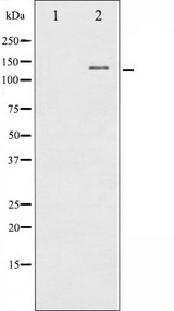 c-CBL Antibody - Western blot analysis of CBL expression in Na2VO3 treated HepG2 whole cells lysates. The lane on the left is treated with the antigen-specific peptide.