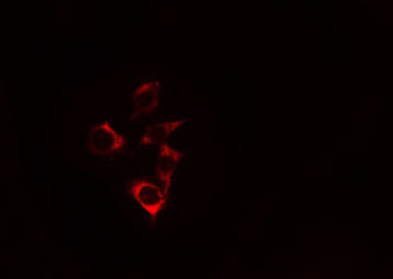 c-CBL Antibody - Staining HeLa cells by IF/ICC. The samples were fixed with PFA and permeabilized in 0.1% Triton X-100, then blocked in 10% serum for 45 min at 25°C. The primary antibody was diluted at 1:200 and incubated with the sample for 1 hour at 37°C. An Alexa Fluor 594 conjugated goat anti-rabbit IgG (H+L) antibody, diluted at 1/600, was used as secondary antibody.