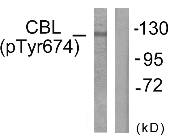 c-CBL Antibody - Western blot analysis of lysates from HepG2 cells treated with Na2VO3 0.3nM 40', using CBL (Phospho-Tyr674) Antibody. The lane on the right is blocked with the phospho peptide.