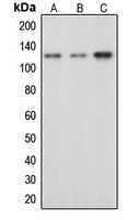 c-CBL Antibody - Western blot analysis of c-CBL (pY674) expression in HeLa EGF-treated (A); mouse liver (B); rat liver (C) whole cell lysates.