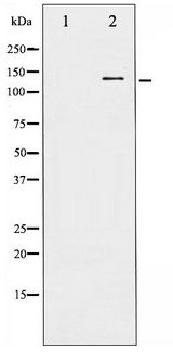 c-CBL Antibody - Western blot of CBL phosphorylation expression in Na2VO3 treated HepG2 whole cell lysates,The lane on the left is treated with the antigen-specific peptide.