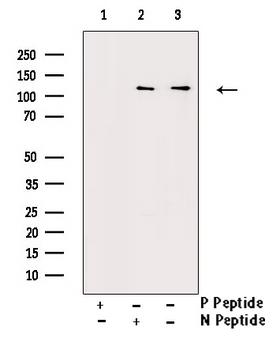 c-CBL Antibody - Western blot analysis of Phospho-CBL (Tyr674) antibody expression in Na2VO3 treated HepG2 cells lysates. The lane on the right is treated with the antigen-specific peptide.