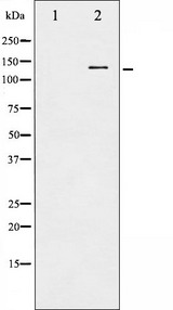 c-CBL Antibody - Western blot analysis of CBL phosphorylation expression in Na2VO3 treated HepG2 whole cells lysates. The lane on the left is treated with the antigen-specific peptide.