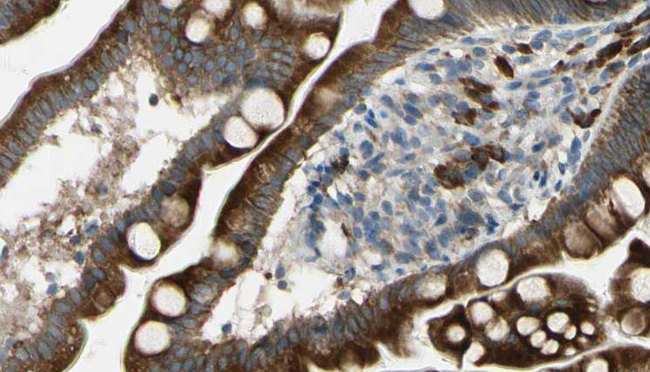 c-CBL Antibody - 1:100 staining mouse intestine tissue by IHC-P. The sample was formaldehyde fixed and a heat mediated antigen retrieval step in citrate buffer was performed. The sample was then blocked and incubated with the antibody for 1.5 hours at 22°C. An HRP conjugated goat anti-rabbit antibody was used as the secondary.