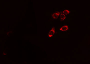 c-CBL Antibody - Staining HeLa cells by IF/ICC. The samples were fixed with PFA and permeabilized in 0.1% Triton X-100, then blocked in 10% serum for 45 min at 25°C. The primary antibody was diluted at 1:200 and incubated with the sample for 1 hour at 37°C. An Alexa Fluor 594 conjugated goat anti-rabbit IgG (H+L) antibody, diluted at 1/600, was used as secondary antibody.