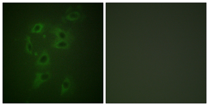 c-CBL Antibody - Immunofluorescence analysis of HepG2 cells, using CBL (Phospho-Tyr700) Antibody. The picture on the right is blocked with the phospho peptide.