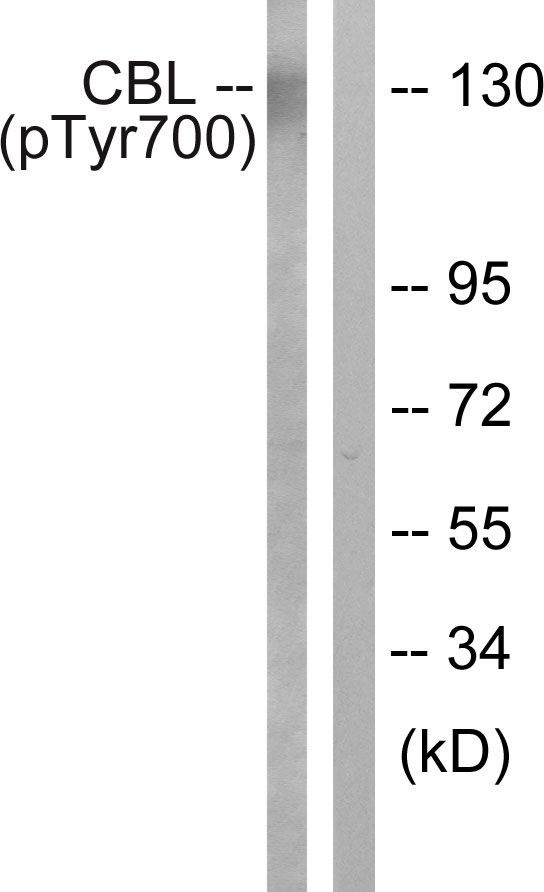 c-CBL Antibody - Western blot analysis of lysates from K562 cells treated with Na3VO4 0.3nM, using CBL (Phospho-Tyr700) Antibody. The lane on the right is blocked with the phospho peptide.