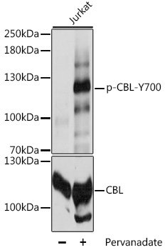 c-CBL Antibody - Western blot analysis of extracts of Jurkat cells, using Phospho-CBL-Y700 antibody at 1:2000 dilution or CBL antibody. Jurkat cells were treated by Pervanadate (1 mM) at 37â„ƒ for 30 minutes. The secondary antibody used was an HRP Goat Anti-Rabbit IgG (H+L) at 1:10000 dilution. Lysates were loaded 25ug per lane and 3% nonfat dry milk in TBST was used for blocking. Blocking buffer: 3% BSA.An ECL Kit was used for detection and the exposure time was 5s.