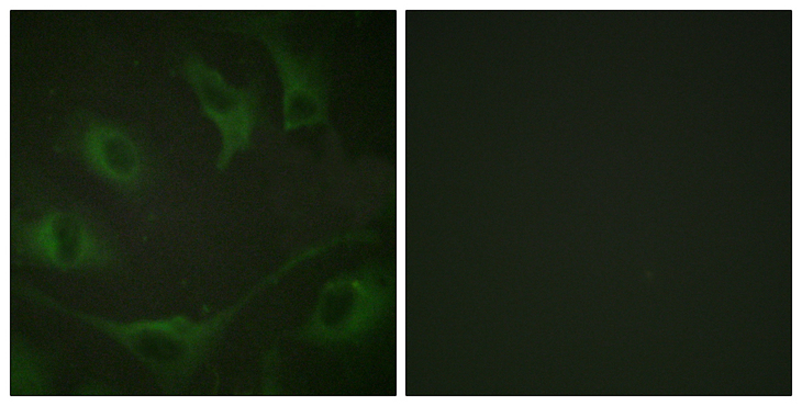 c-CBL Antibody - Immunofluorescence analysis of A549 cells, using CBL (Phospho-Tyr774) Antibody. The picture on the right is blocked with the phospho peptide.