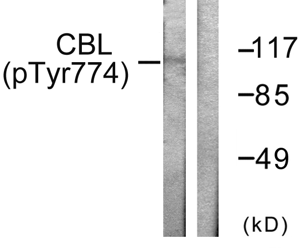 c-CBL Antibody - Western blot analysis of lysates from HeLa cells treated with EGF 200ng/ml 30', using CBL (Phospho-Tyr774) Antibody. The lane on the right is blocked with the phospho peptide.