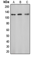 c-CBL Antibody - Western blot analysis of c-CBL (pY774) expression in Jurkat (A); mouse liver (B); rat liver (C) whole cell lysates.