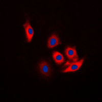 c-CBL Antibody - Immunofluorescent analysis of c-CBL (pY774) staining in Jurkat cells. Formalin-fixed cells were permeabilized with 0.1% Triton X-100 in TBS for 5-10 minutes and blocked with 3% BSA-PBS for 30 minutes at room temperature. Cells were probed with the primary antibody in 3% BSA-PBS and incubated overnight at 4 C in a humidified chamber. Cells were washed with PBST and incubated with a DyLight 594-conjugated secondary antibody (red) in PBS at room temperature in the dark. DAPI was used to stain the cell nuclei (blue).