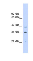 C/EBP Alpha / CEBPA Antibody - CEBPA / CEBP Alpha antibody Western blot of HeLa lysate. This image was taken for the unconjugated form of this product. Other forms have not been tested.