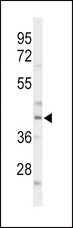 C/EBP Alpha / CEBPA Antibody - Western blot of CEBPA Antibody in mouse liver tissue lysates (35 ug/lane). CEBPA (arrow) was detected using the purified antibody.