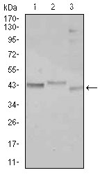 C/EBP Alpha / CEBPA Antibody - Western blot using CEBPA mouse monoclonal antibody against Jurkat (1), k562 (2), and HepG2 (3) cell lysate.