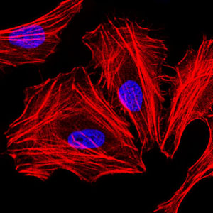 C/EBP Alpha / CEBPA Antibody - Immunofluorescence of HeLa cells. Blue: DRAQ5 fluorescent DNA dye. Red: Actin filaments have been labeled with Alexa Fluor-555 phalloidin.