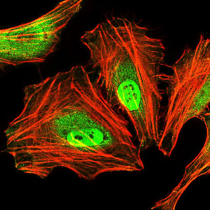 C/EBP Alpha / CEBPA Antibody - Immunofluorescence of HeLa cells using CEBPA mouse monoclonal antibody (green). Blue: DRAQ5 fluorescent DNA dye. Red: Actin filaments have been labeled with Alexa Fluor-555 phalloidin.