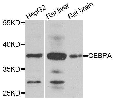 C/EBP Alpha / CEBPA Antibody - Western blot analysis of extracts of various cell lines, using CEBPA antibody at 1:1000 dilution. The secondary antibody used was an HRP Goat Anti-Rabbit IgG (H+L) at 1:10000 dilution. Lysates were loaded 25ug per lane and 3% nonfat dry milk in TBST was used for blocking. An ECL Kit was used for detection and the exposure time was 15s.