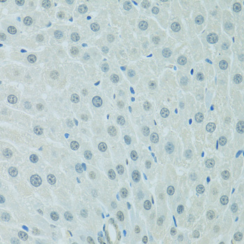 C/EBP Alpha / CEBPA Antibody - Immunohistochemistry of paraffin-embedded rat liver using CEBPA antibodyat dilution of 1:100 (40x lens).