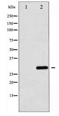 C/EBP Alpha / CEBPA Antibody - Western blot of C/EBP-alpha expression in 293 whole cell lysates,The lane on the left is treated with the antigen-specific peptide.