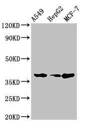 C/EBP Alpha / CEBPA Antibody - Western Blot Positive WB detected in: A549 whole cell lysate, HepG2 whole cell lysate, MCF-7 whole cell lysate All lanes: CEBPA antibody at 2µg/ml Secondary Goat polyclonal to rabbit IgG at 1/50000 dilution Predicted band size: 38, 36, 26, 42 kDa Observed band size: 38 kDa