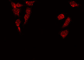 C/EBP Alpha / CEBPA Antibody - Staining HepG2 cells by IF/ICC. The samples were fixed with PFA and permeabilized in 0.1% Triton X-100, then blocked in 10% serum for 45 min at 25°C. The primary antibody was diluted at 1:200 and incubated with the sample for 1 hour at 37°C. An Alexa Fluor 594 conjugated goat anti-rabbit IgG (H+L) Ab, diluted at 1/600, was used as the secondary antibody.
