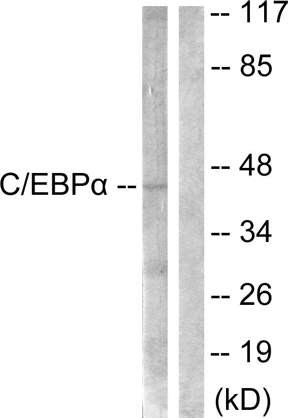C/EBP Alpha / CEBPA Antibody - Western blot analysis of extracts from 293 cells treated with Insulin (0.01U/ml, 15mins), using C/EBP-a (Ab-21) antibody.