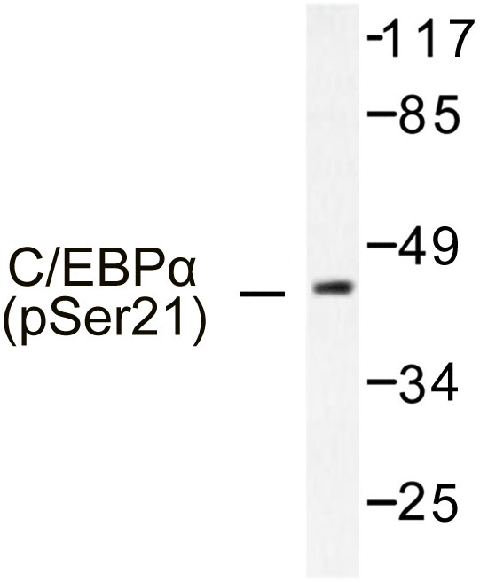 C/EBP Alpha / CEBPA Antibody - Western blot of p-C/EBP alpha (S21) pAb in extracts from HepG2 cells treated with EGF.