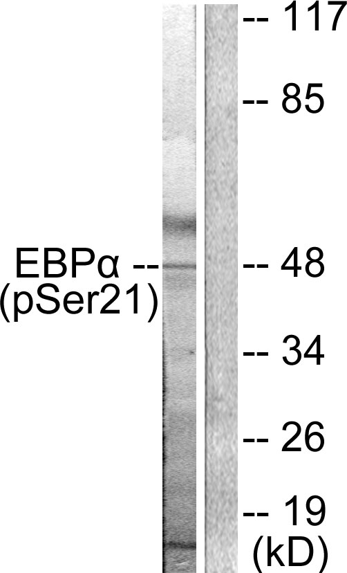 C/EBP Alpha / CEBPA Antibody - Western blot analysis of lysates from HepG2 cells treated with EGF 200ng/ml 5', using C/EBP-alpha (Phospho-Ser21) Antibody. The lane on the right is blocked with the phospho peptide.