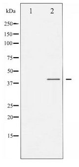 C/EBP Alpha / CEBPA Antibody - Western blot of C/EBP- alpha phosphorylation expression in EGF treated HepG2 whole cell lysates,The lane on the left is treated with the antigen-specific peptide.