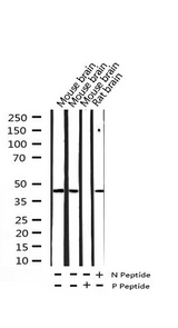 C/EBP Alpha / CEBPA Antibody - Western blot analysis of Phospho-C/EBP alpha (Ser21) expression in various lysates