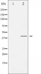 C/EBP Alpha / CEBPA Antibody - Western blot analysis of C/EBP-alpha phosphorylation expression in EGF treated HepG2 whole cells lysates. The lane on the left is treated with the antigen-specific peptide.