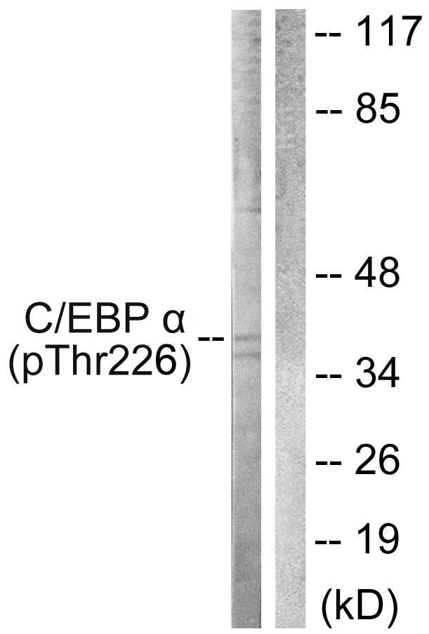 C/EBP Alpha / CEBPA Antibody - Western blot analysis of lysates from COS7 cells treated with EGF 200ng/ml 30', using C/EBP-alpha (Phospho-Thr226) Antibody. The lane on the right is blocked with the phospho peptide.