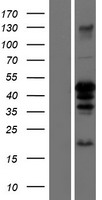C/EBP Alpha / CEBPA Protein - Western validation with an anti-DDK antibody * L: Control HEK293 lysate R: Over-expression lysate