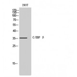 C/EBP Beta / CEBPB Antibody - Western blot of C/EBP beta antibody