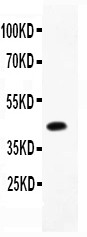 C/EBP Beta / CEBPB Antibody - CEBP Beta antibody Western blot. All lanes: Anti CEBP Beta at 0.5 ug/ml. WB: Recombinant Human CEBP Beta Protein 0.5ng. Predicted band size: 42 kD. Observed band size: 42 kD.