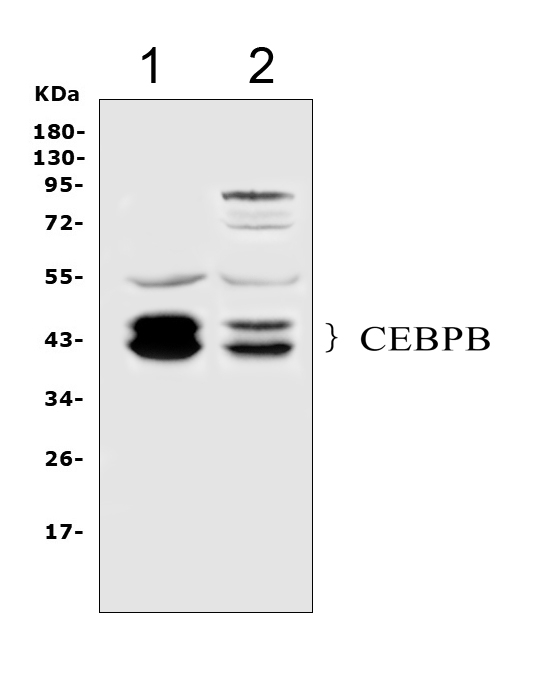 C/EBP Beta / CEBPB Antibody - Western blot analysis of CEBP Beta using anti-CEBP Beta antibody. Electrophoresis was performed on a 5-20% SDS-PAGE gel at 70V (Stacking gel) / 90V (Resolving gel) for 2-3 hours. The sample well of each lane was loaded with 50ug of sample under reducing conditions. Lane 1: human Hela whole cell lysates, Lane 2: human Caco-2 whole cell lysates. After Electrophoresis, proteins were transferred to a Nitrocellulose membrane at 150mA for 50-90 minutes. Blocked the membrane with 5% Non-fat Milk/ TBS for 1.5 hour at RT. The membrane was incubated with rabbit anti-CEBP Beta antigen affinity purified polyclonal antibody at 0.5 µg/mL overnight at 4°C, then washed with TBS-0.1% Tween 3 times with 5 minutes each and probed with a goat anti-rabbit IgG-HRP secondary antibody at a dilution of 1:10000 for 1.5 hour at RT. The signal is developed using an Enhanced Chemiluminescent detection (ECL) kit with Tanon 5200 system. A specific band was detected for CEBP Beta at approximately 42-46KD. The expected band size for CEBP Beta is at 36KD.
