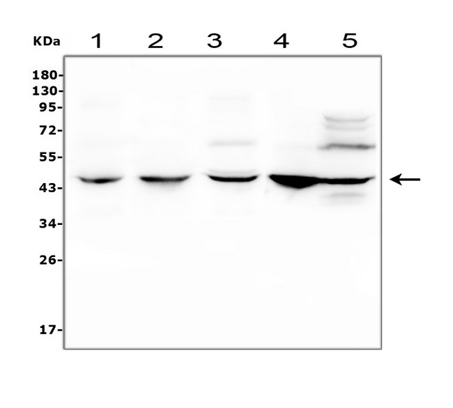 C/EBP Beta / CEBPB Antibody - Western blot analysis of CEBP Beta using anti-CEBP Beta antibody. Electrophoresis was performed on a 5-20% SDS-PAGE gel at 70V (Stacking gel) / 90V (Resolving gel) for 2-3 hours. The sample well of each lane was loaded with 50ug of sample under reducing conditions. Lane 1: rat liver tissue lysates, Lane 2: rat kidney tissue lysates, Lane 3: mouse liver tissue lysates, Lane 4: mouse kidney tissue lysates, Lane 5: human Hela whole cell lysates. After Electrophoresis, proteins were transferred to a Nitrocellulose membrane at 150mA for 50-90 minutes. Blocked the membrane with 5% Non-fat Milk/ TBS for 1.5 hour at RT. The membrane was incubated with rabbit anti-CEBP Beta antigen affinity purified polyclonal antibody at 0.5 µg/mL overnight at 4°C, then washed with TBS-0.1% Tween 3 times with 5 minutes each and probed with a goat anti-rabbit IgG-HRP secondary antibody at a dilution of 1:10000 for 1.5 hour at RT. The signal is developed using an Enhanced Chemiluminescent detection (ECL) kit with Tanon 5200 system. A specific band was detected for CEBP Beta at approximately 46KD. The expected band size for CEBP Beta is at 36KD.