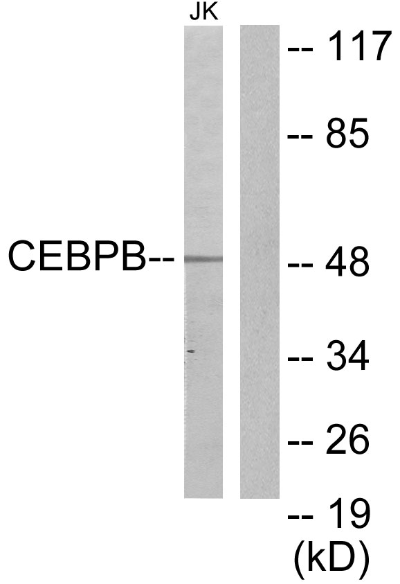 C/EBP Beta / CEBPB Antibody - Western blot analysis of lysates from Jurkat cells, using CEBPB Antibody. The lane on the right is blocked with the synthesized peptide.