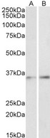 C/EBP Beta / CEBPB Antibody - Goat Anti-CEBPB (aa68-81) Antibody (1µg/ml) staining of Human Skin (A) and Pig Lung (B) lysates (35µg protein in RIPA buffer). Primary incubation was 1 hour. Detected by chemiluminescencence.