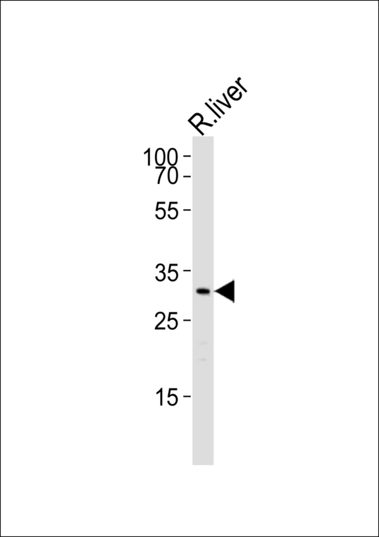 C/EBP Beta / CEBPB Antibody - Western blot of lysate from R. liver cell line with rat-Cebpb-S105. Antibody was diluted at 1:1000. A goat anti-rabbit IgG H&L (HRP) at 1:5000 dilution was used as the secondary antibody. Lysate at 35 ug.