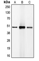 C/EBP Beta / CEBPB Antibody - Western blot analysis of C/EBP beta expression in HeLa (A); NIH3T3 (B); Jurkat (C) whole cell lysates.