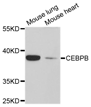 C/EBP Beta / CEBPB Antibody - Western blot analysis of extracts of various cell lines, using CEBPB antibody at 1:1000 dilution. The secondary antibody used was an HRP Goat Anti-Rabbit IgG (H+L) at 1:10000 dilution. Lysates were loaded 25ug per lane and 3% nonfat dry milk in TBST was used for blocking. An ECL Kit was used for detection and the exposure time was 90s.