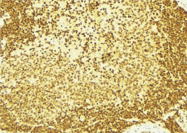 C/EBP Beta / CEBPB Antibody - 1:100 staining mouse spleen tissue by IHC-P. The sample was formaldehyde fixed and a heat mediated antigen retrieval step in citrate buffer was performed. The sample was then blocked and incubated with the antibody for 1.5 hours at 22°C. An HRP conjugated goat anti-rabbit antibody was used as the secondary.