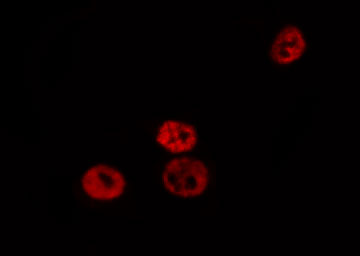 C/EBP Beta / CEBPB Antibody - Staining HepG2 cells by IF/ICC. The samples were fixed with PFA and permeabilized in 0.1% Triton X-100, then blocked in 10% serum for 45 min at 25°C. The primary antibody was diluted at 1:200 and incubated with the sample for 1 hour at 37°C. An Alexa Fluor 594 conjugated goat anti-rabbit IgG (H+L) Ab, diluted at 1/600, was used as the secondary antibody.