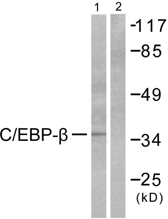 C/EBP Beta / CEBPB Antibody - Western blot analysis of extracts from NIH/3T3 cells, using C/EBP-ß (Ab-235/188) antibody.