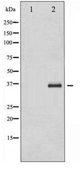 C/EBP Beta / CEBPB Antibody - Western blot of C/EBP- beta phosphorylation expression in HepG2 whole cell lysates,The lane on the left is treated with the antigen-specific peptide.