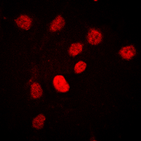 C/EBP Beta / CEBPB Antibody - Immunofluorescent analysis of C/EBP beta (pT235) staining in HEK293T cells. Formalin-fixed cells were permeabilized with 0.1% Triton X-100 in TBS for 5-10 minutes and blocked with 3% BSA-PBS for 30 minutes at room temperature. Cells were probed with the primary antibody in 3% BSA-PBS and incubated overnight at 4 deg C in a humidified chamber. Cells were washed with PBST and incubated with a DyLight 594-conjugated secondary antibody (red) in PBS at room temperature in the dark. DAPI was used to stain the cell nuclei (blue).